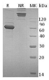 SDS-PAGE (ULBP1-05H).jpg